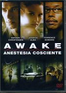 AWAKE - Anestesia cosciente
